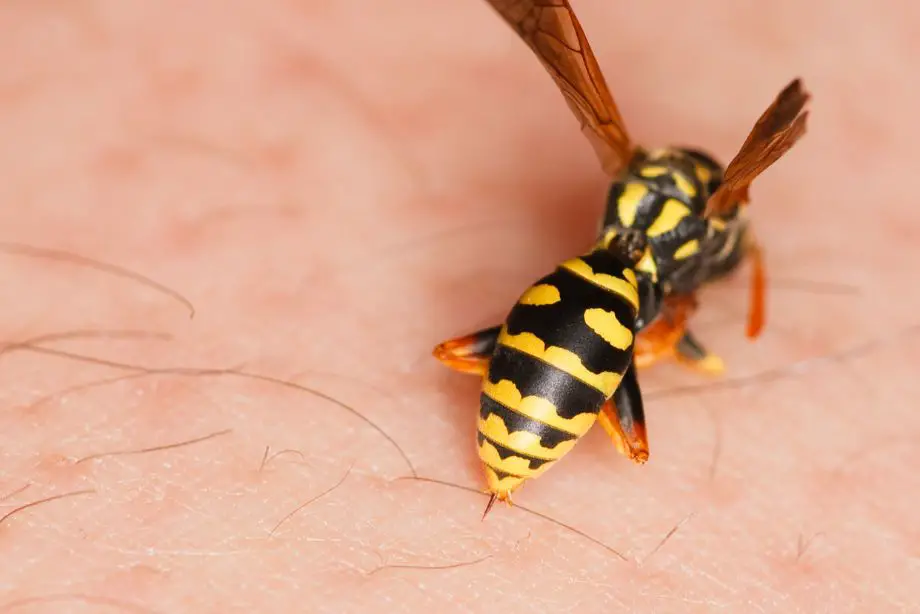 Remède de grand-mère contre le gonflement dû à une piqûre de guêpe